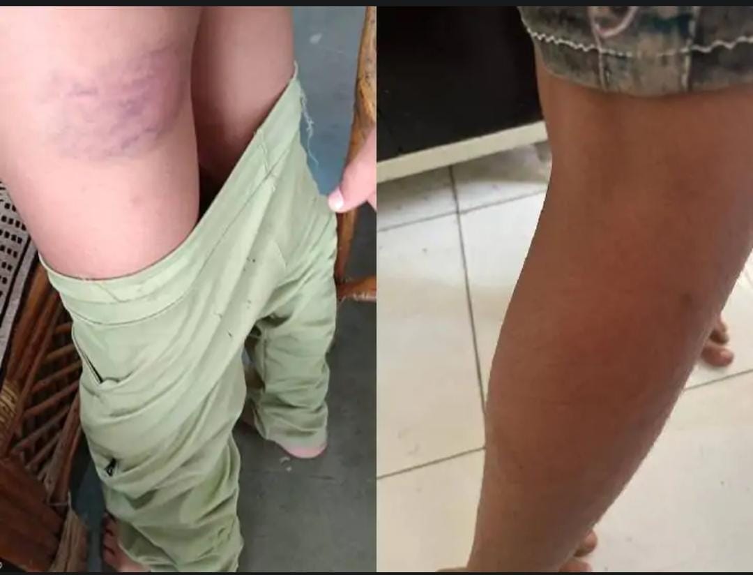 The warden beat the student in the hostel for using mobile, the matter reached the police station