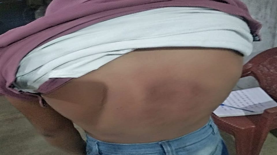 Student brutally thrashed in school in Mainpuri