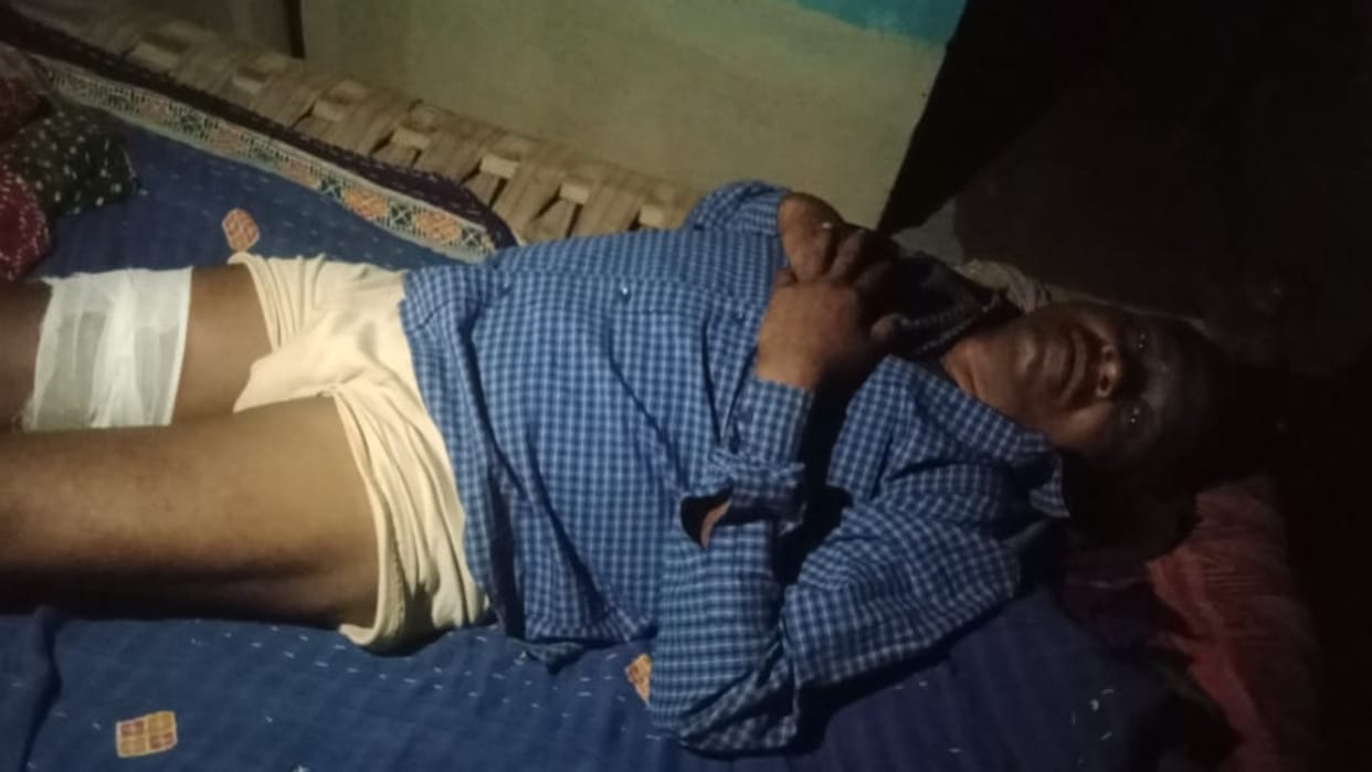 Umaria News Wild pig attacked a person of Gram Panchayat Sehra Tola condition critical