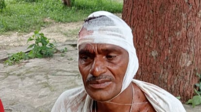 Varanasi: वाराणसी में इतनी सी बात पर दो पक्षों में जमकर चले लाठी-डंडे, खूनी संघर्ष में डेढ़ दर्जन लोग घायल Two sides fiercely fought with sticks on the dispute of breaking guava in Varanasi, bloody struggle