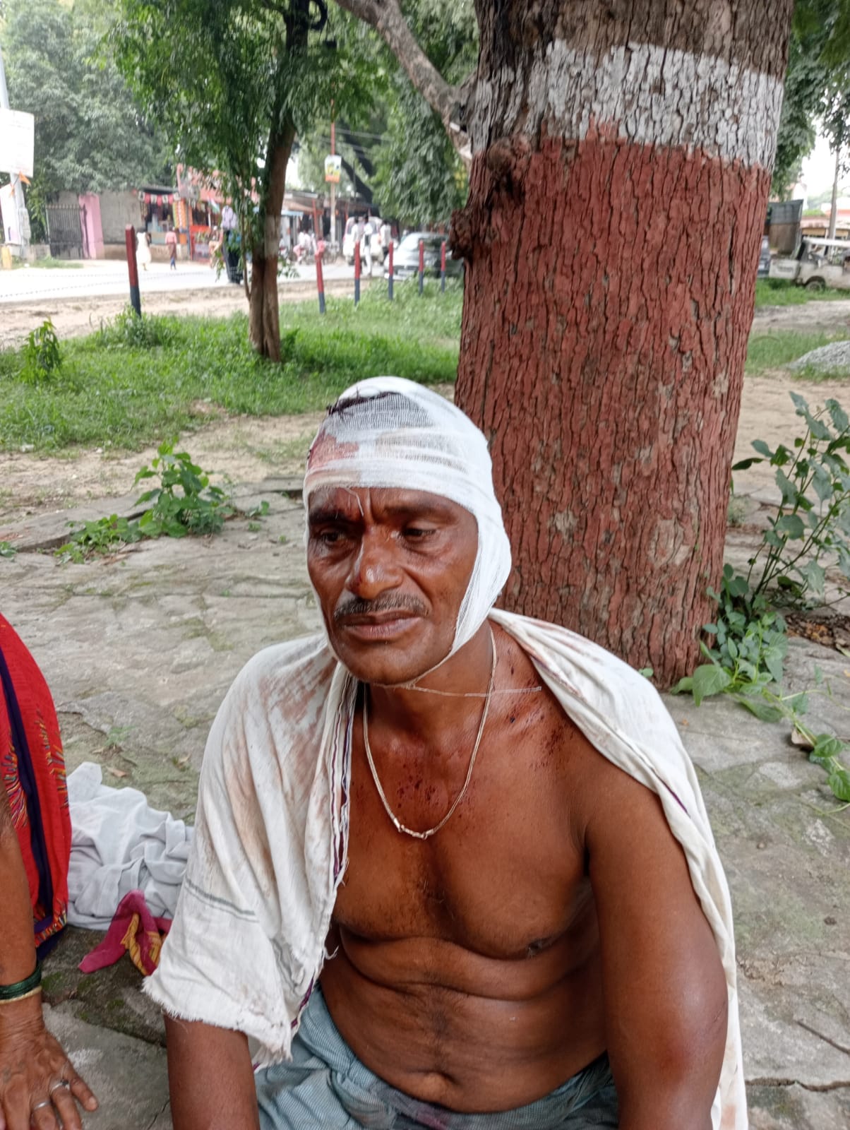 Two sides fiercely fought with sticks on the dispute of breaking guava in Varanasi, bloody struggle