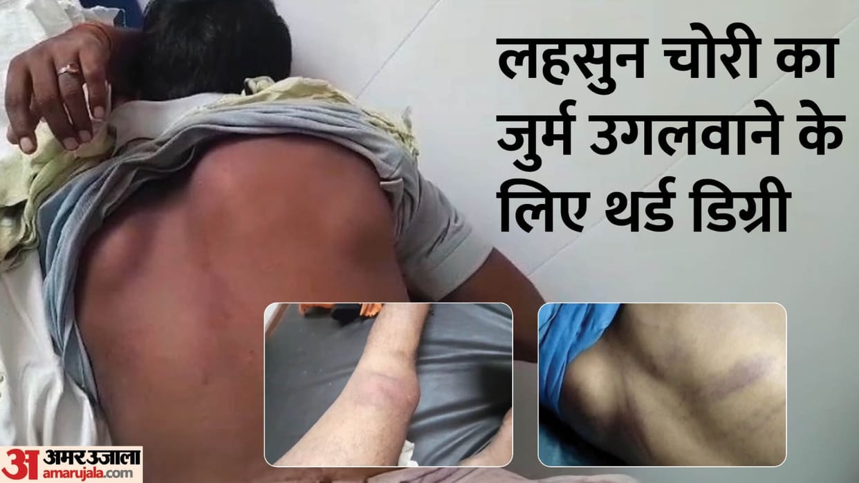 Police gave third degree in police station to expose crime of stealing garlic in Kannauj