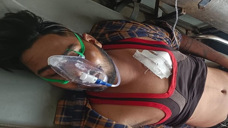 Brother-in-law and sister-in-law fell asleep bike both were injured