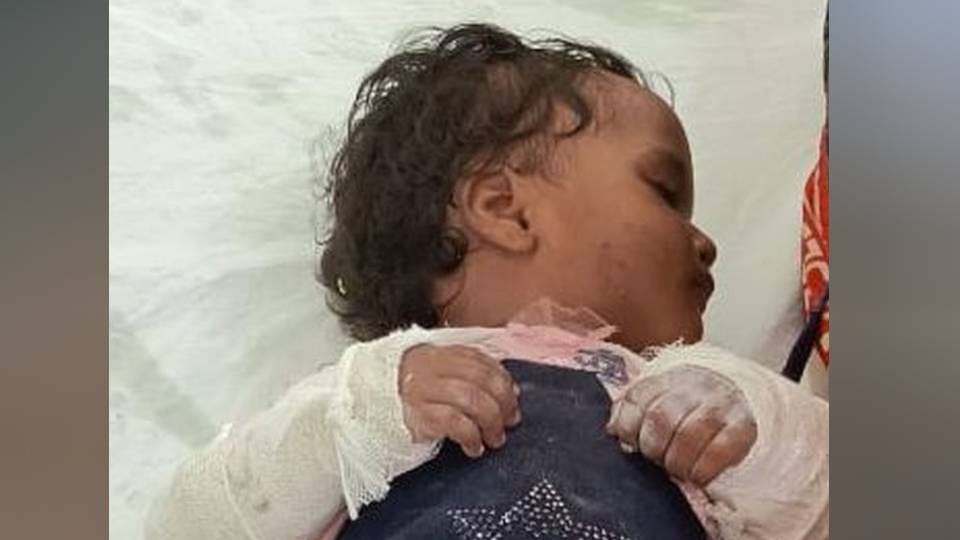 Drunken father broke both hands of one year old girl in Mainpuri she died during treatment
