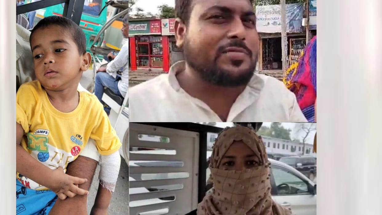 A family got injured in Lucknow while loot.