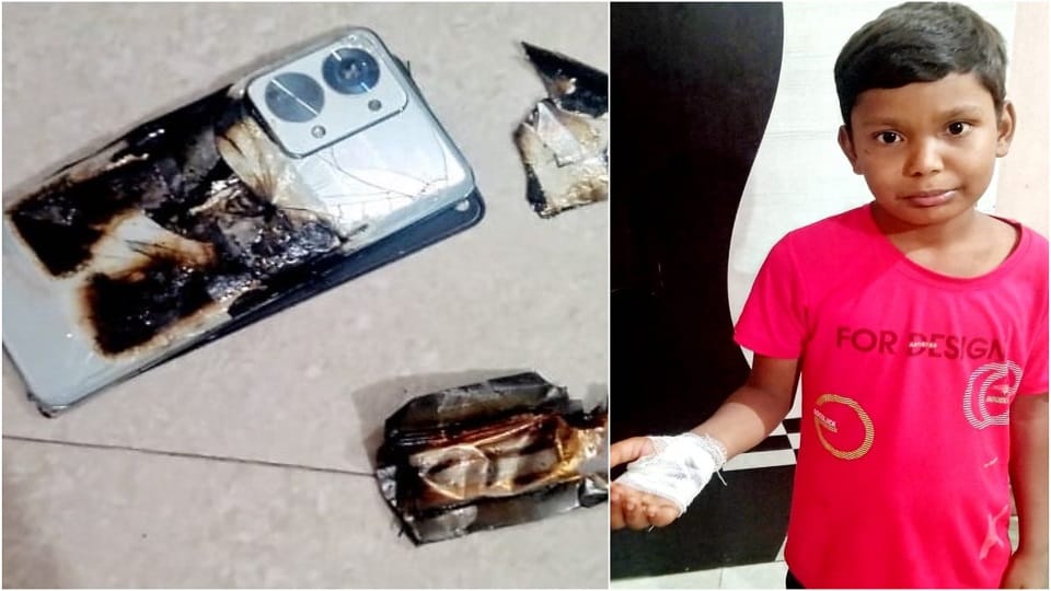 Mobile Phone Blasts then fire child hand scorched in kaganj up news