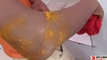 Minor son refused to work in Bareilly father tied him to a tree and beat him