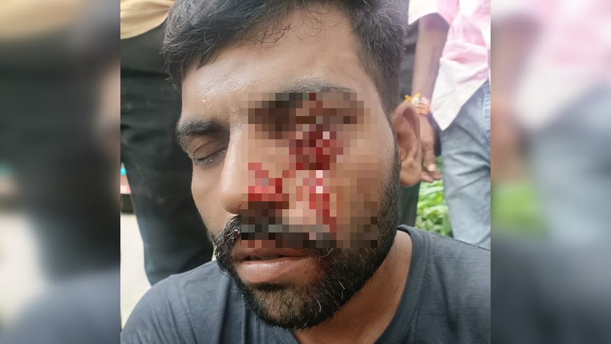 Agriculture officer inserted steel bar in eye of truck driver for not giving him pass In Lucknow