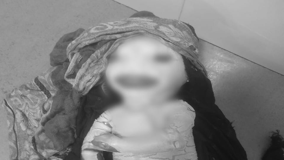 Another Woman Gives Birth To Harlequin Baby like alien In Bareilly