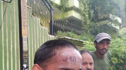 युवक के माथे पर गोदा