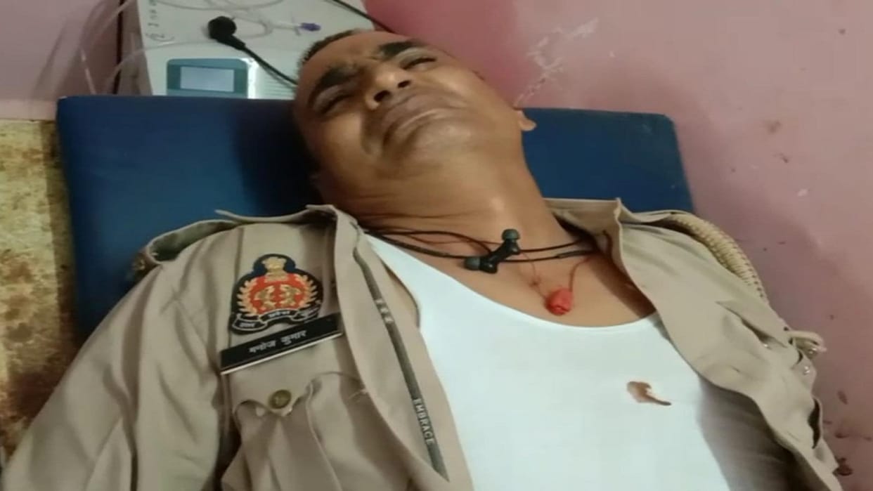 Policeman riding a bike collides with a tree while trying to avoid a truck, condition critical