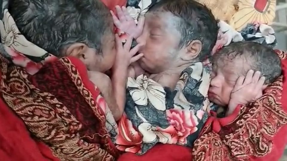 Mother reached home with triplets born together