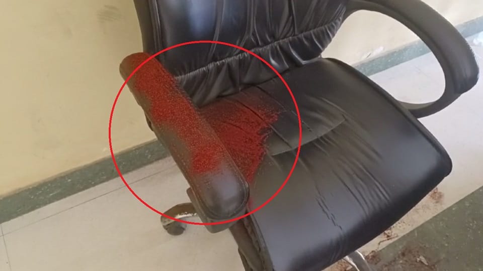 आंख में डालते समय कुर्सी पर गिरी मिर्ची