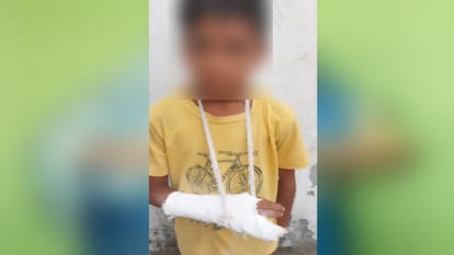 Muzaffarnagar like Kand in Baghpat: teacher accused of breaking hand of class 3 student by hitting with stick