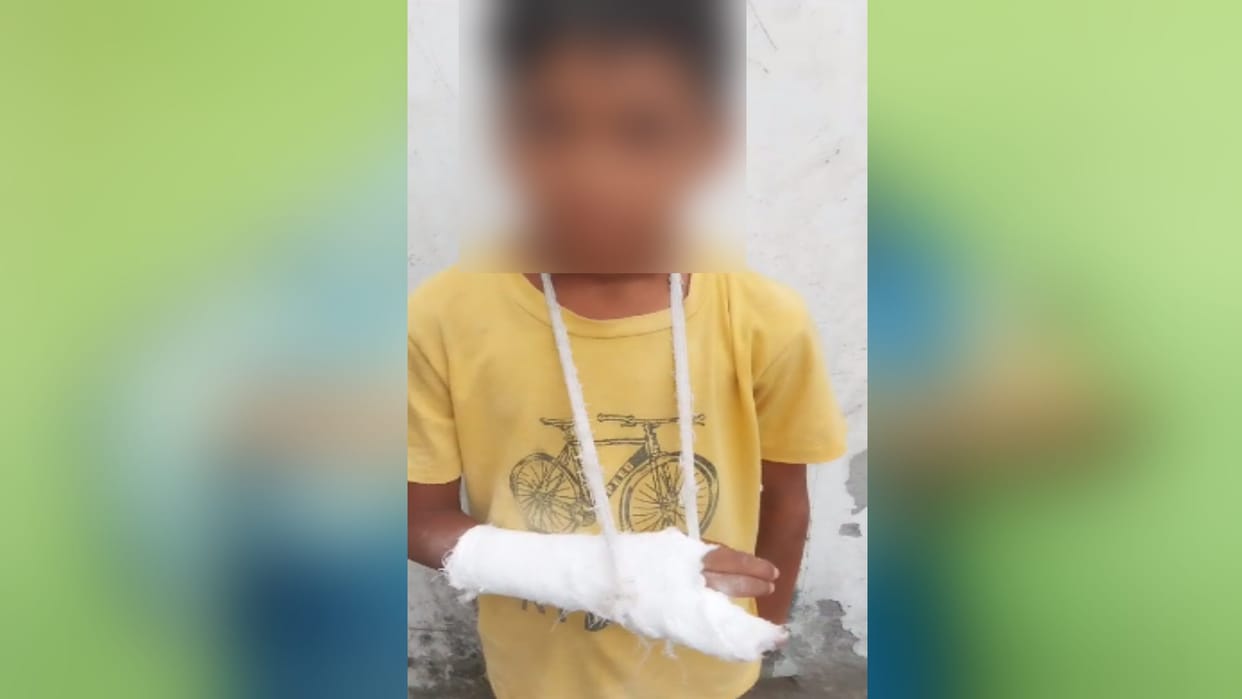 Muzaffarnagar like Kand in Baghpat: teacher accused of breaking hand of class 3 student by hitting with stick