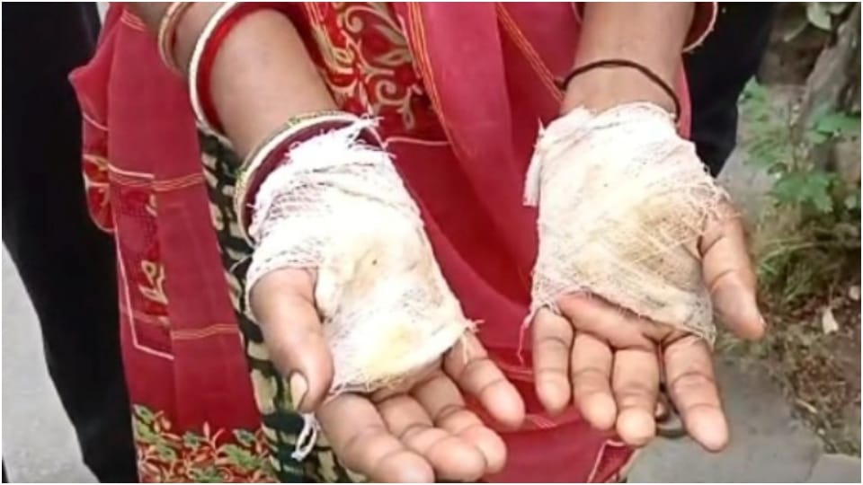Burning both hands by calling Bhabhi a witch devar and devarani committed cruelty with Bhope in Dungarpur