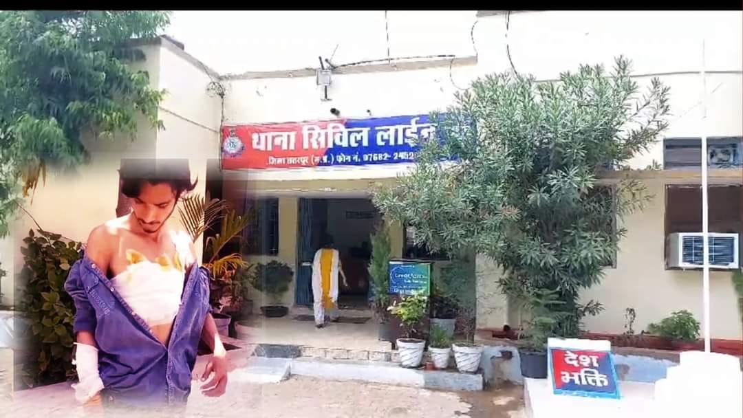 Chhatarpur: Dalit brother and sister were brutally beaten thinking they were lovers