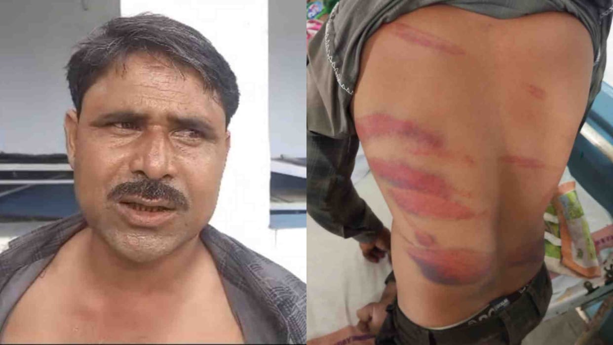 In Damoh, youths brutally beat a disabled shepherd with sticks