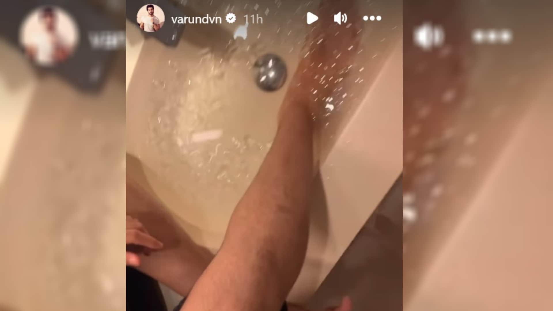 varun dhawan shares his health update after injures leg during atlee film vd18 actor trying ice water therapy