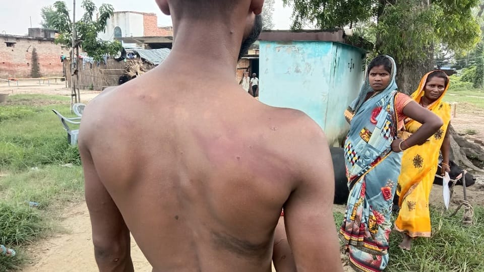 A young man who went to meet his girlfriend was tied to a tree and beaten