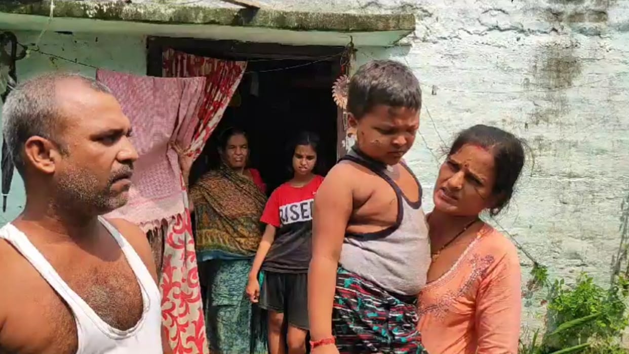 Residents of Khajasarai in Darbhanga troubled by fear of monkeys; about 12 people were bitten