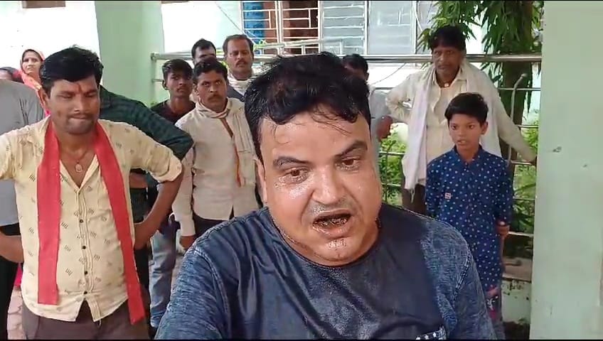 Damoh: Youth tried to commit suicide at Collectorate gate, accused officers, poured diesel on himself