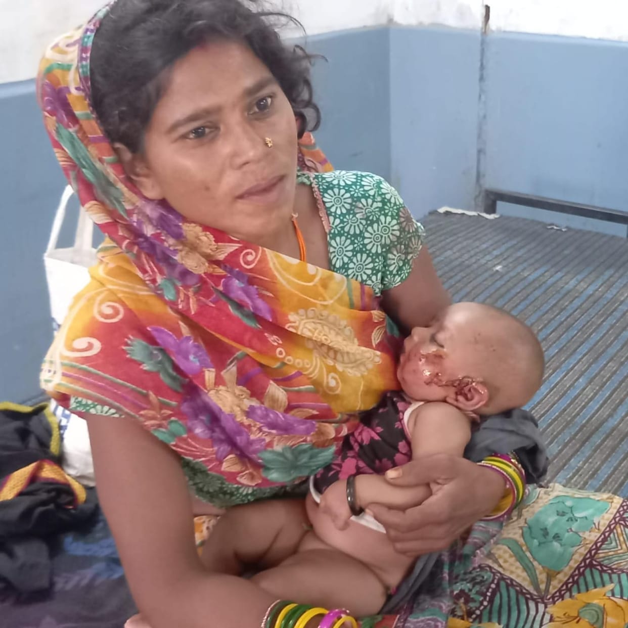 Damoh News:Jackal entered the house and tried to take away one year old innocent child, mother saved her
