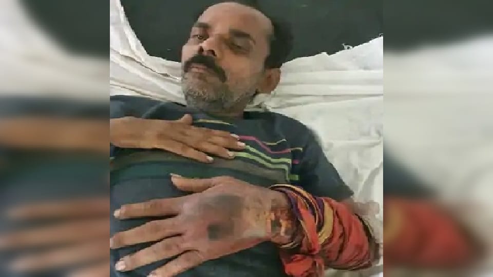 Allegation of bandaging a patient after 30 hours in Kanpur s Ursala Hospital