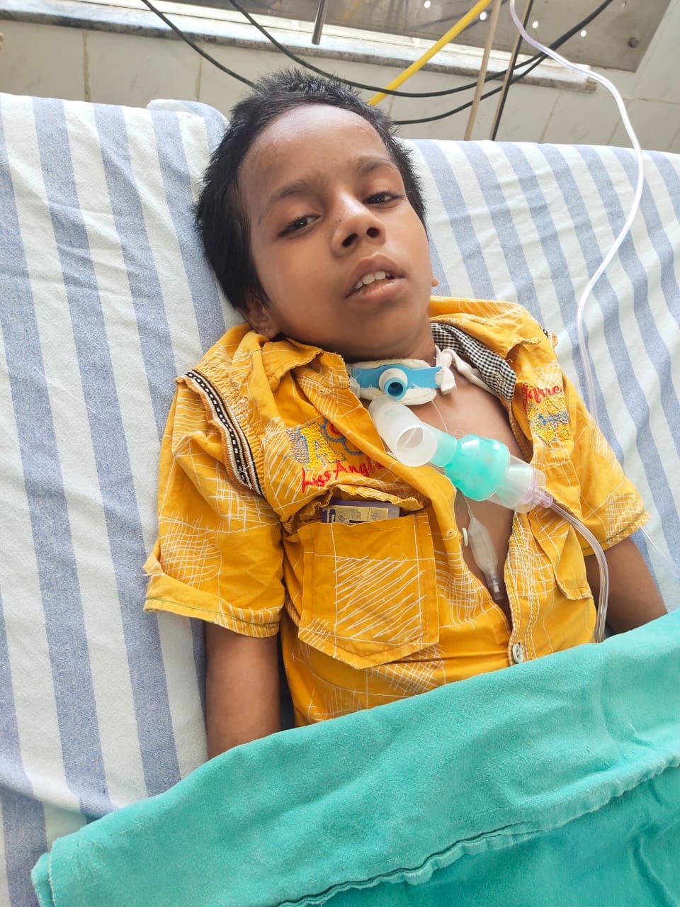 The girl got a new life after one and a half years: The nerves of the brain were torn due to the injury