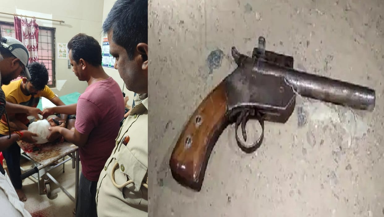 Young man shot himself in the temple with a pistol, was upset due to domestic dispute, referred in critical co