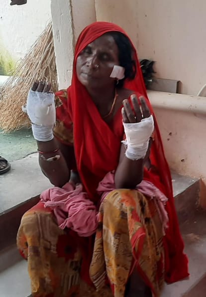 चोरों से डटकर लड़ीं कैलाशी: ट्यूबेल पर चोरी करने आए चोर ने चाकू से किया हमला, महिला ने घायल होकर भी किया सामना The thief who had come to steal on Tubel attacked him with a knife, the woman fought back even after getting i
