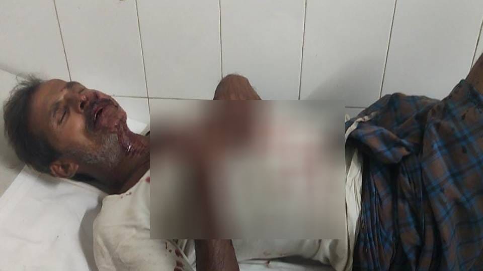 bullies beat up and shot person who tried to intervene during fight In Mainpuri
