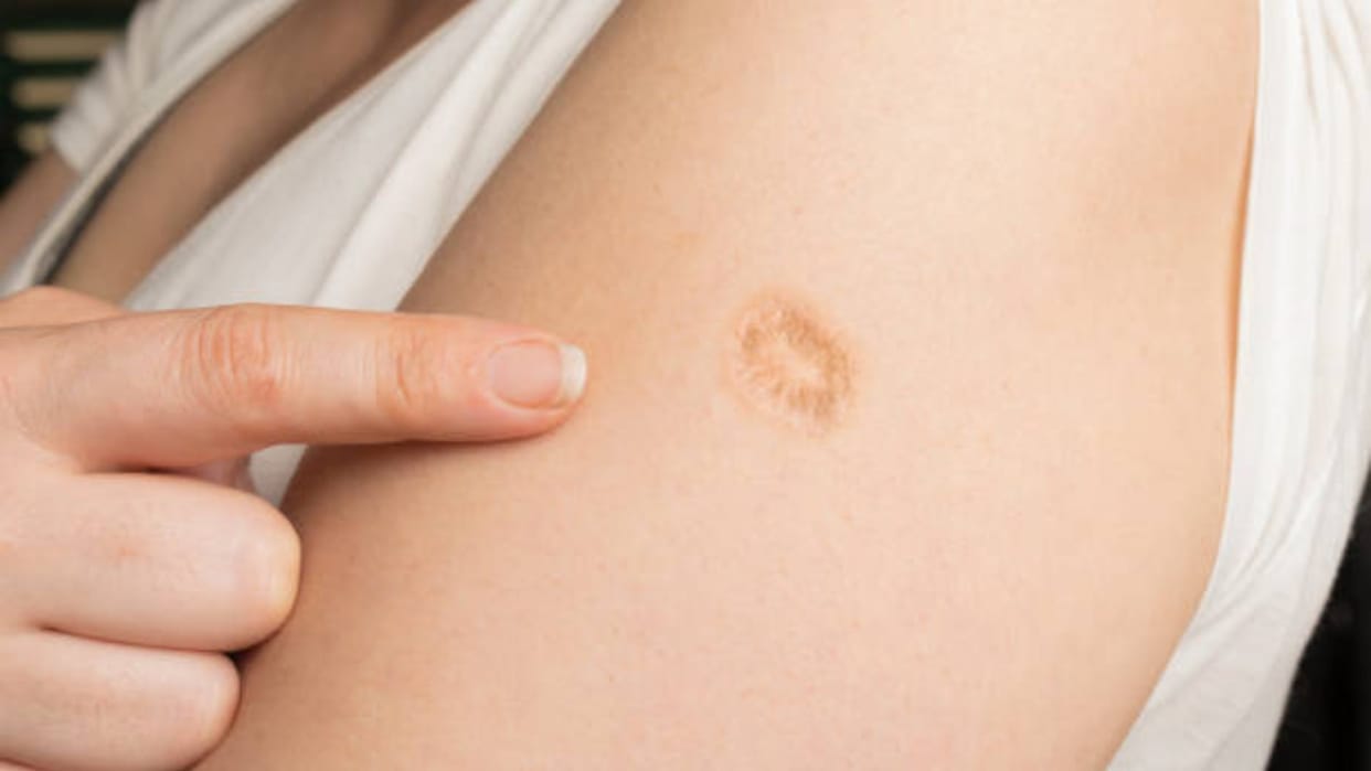 this mark on the arm what is its secret if you dont know then find out