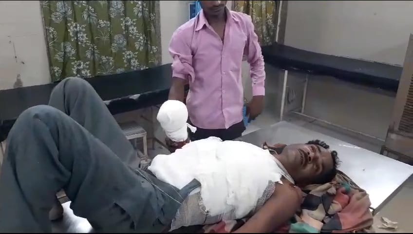 Grenade burst in hand while burning beedi in Damoh, paw separated, referred to Jabalpur for treatment.