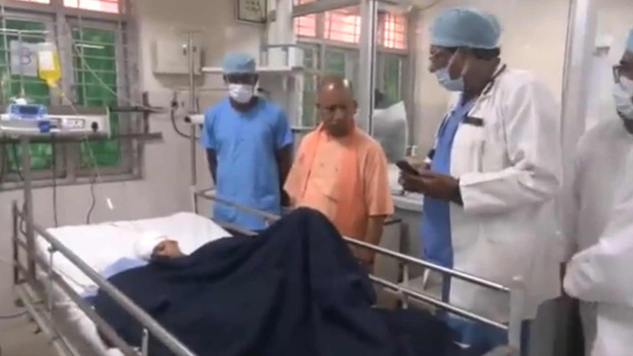 CM yogi reach Brd for Treatment of child injured in Deoria massacre
