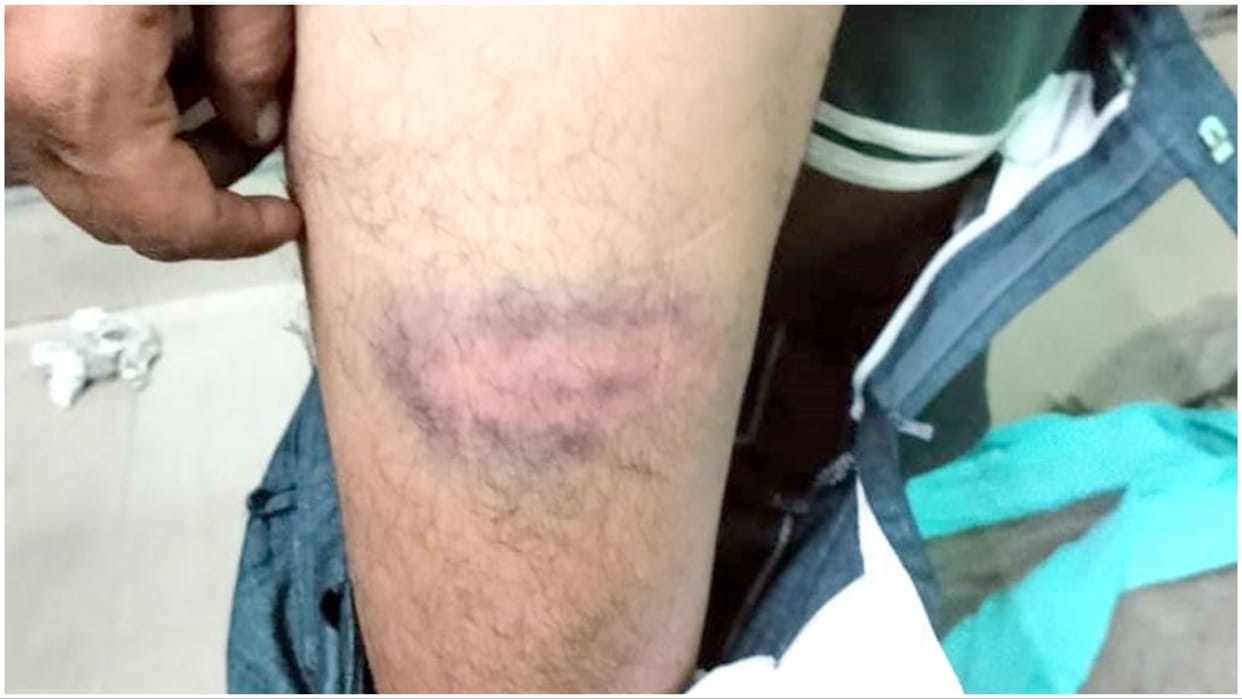 Jind: Dial 112 and police station personnel beat up the youth brutally