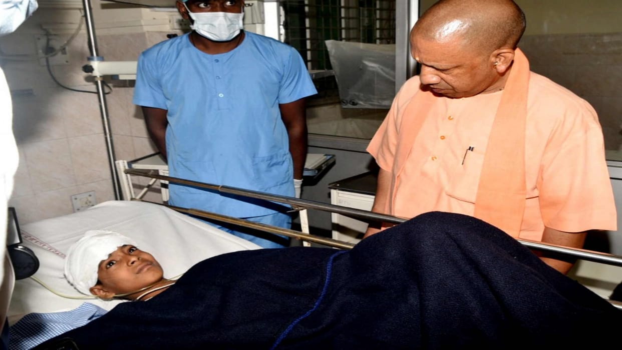 Deoria massacre CM Yogi Adityanath sees injured Anmol in medical college