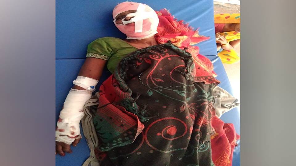 Woman guarding crops seriously injured by attack by wild animals in Agra