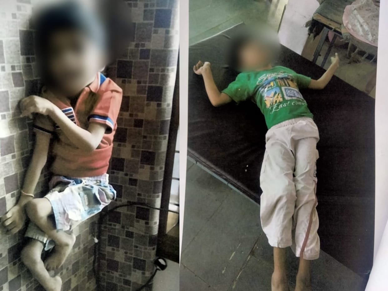 Child suffers incurable disease due to negligence during delivery, hospital and doctor will have to pay compen