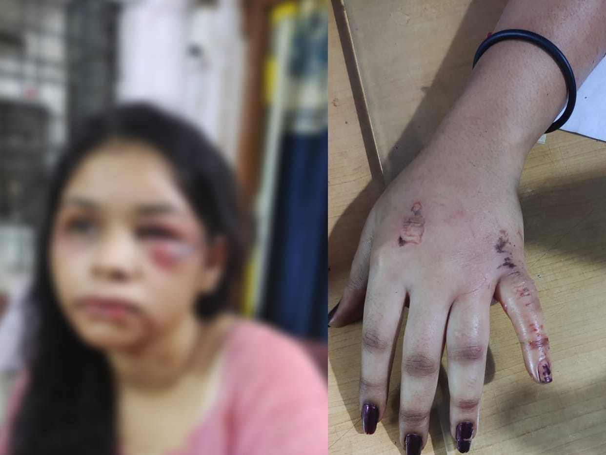 Tantrik placed camphor on girl's tongue in order to remove the obstacle, tongue got burnt