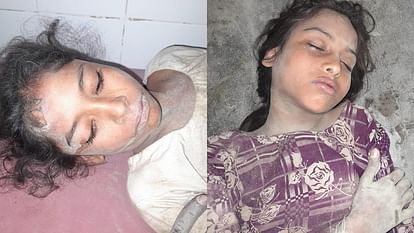 Moradabad: Girl students got burnt due electric shock in Kundarki, while saving one other also got injured