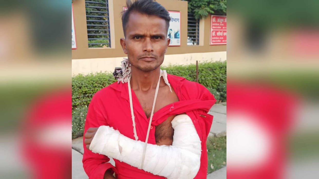 broke shopkeeper hand after angry after accusing him of giving spoiled fish