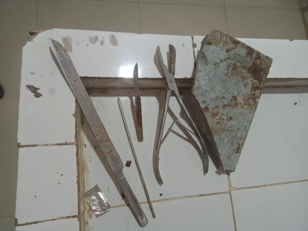 Doctors are breaking the skulls of dead bodies with bricks, even vials are not available to preserve the remai