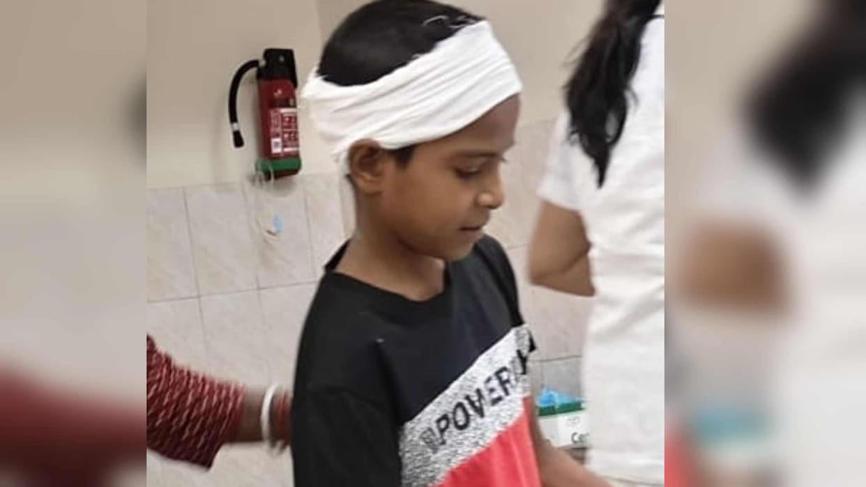Anmol will remain in BRD medical college for two more days