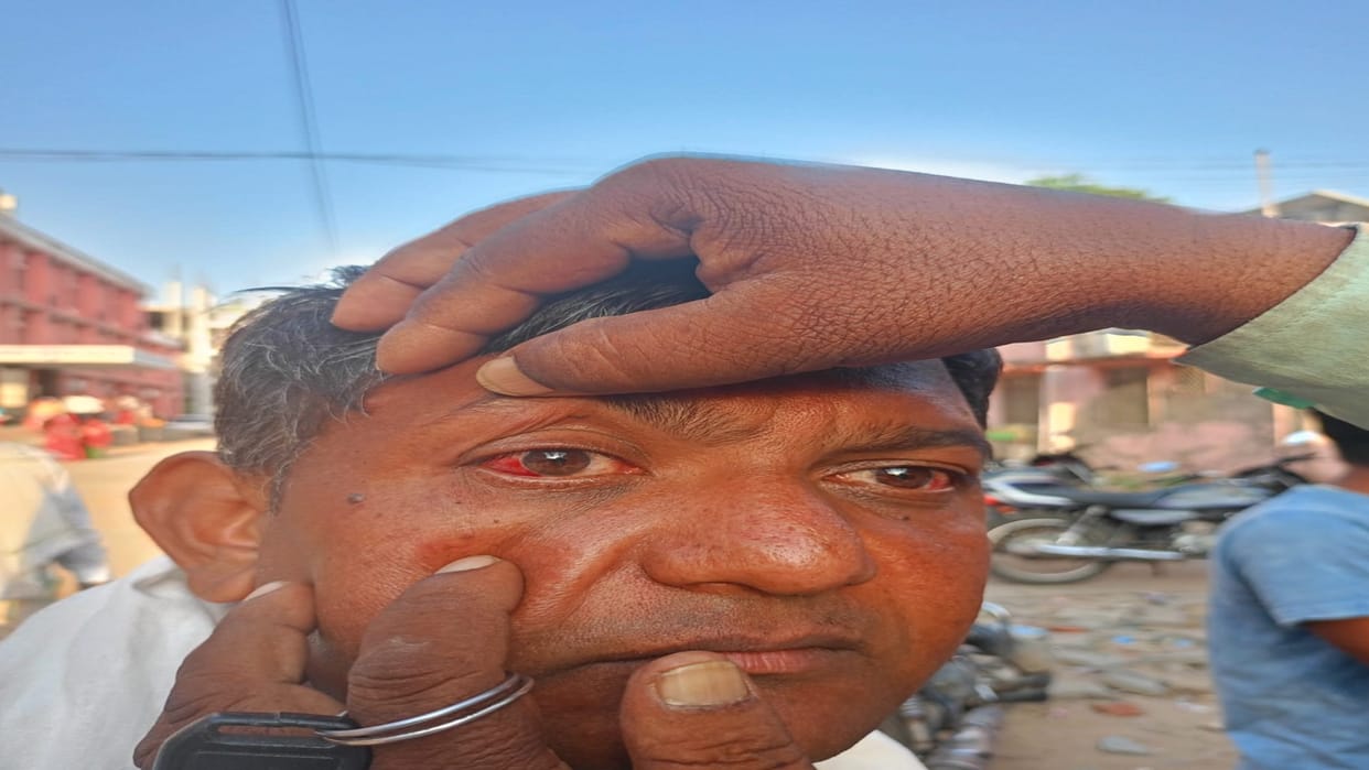 The father who went to give leave to the student accused the college administration of assault