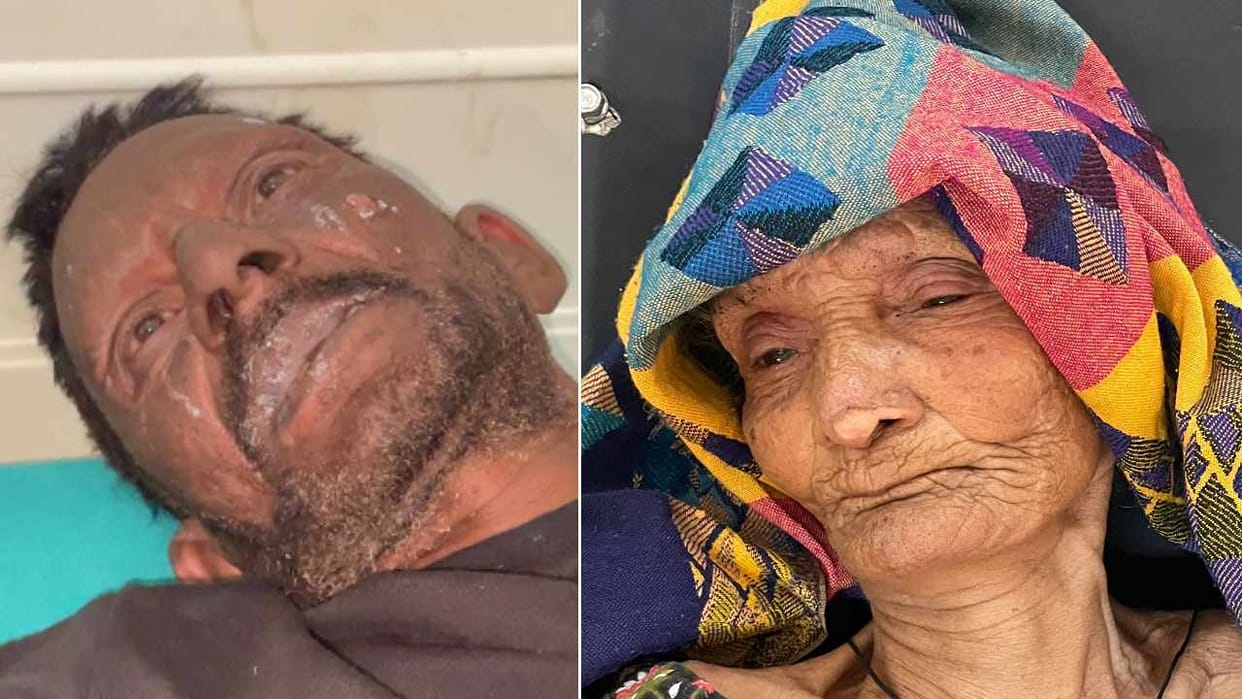 Two people injured in gas cylinder explosion in Faridkot