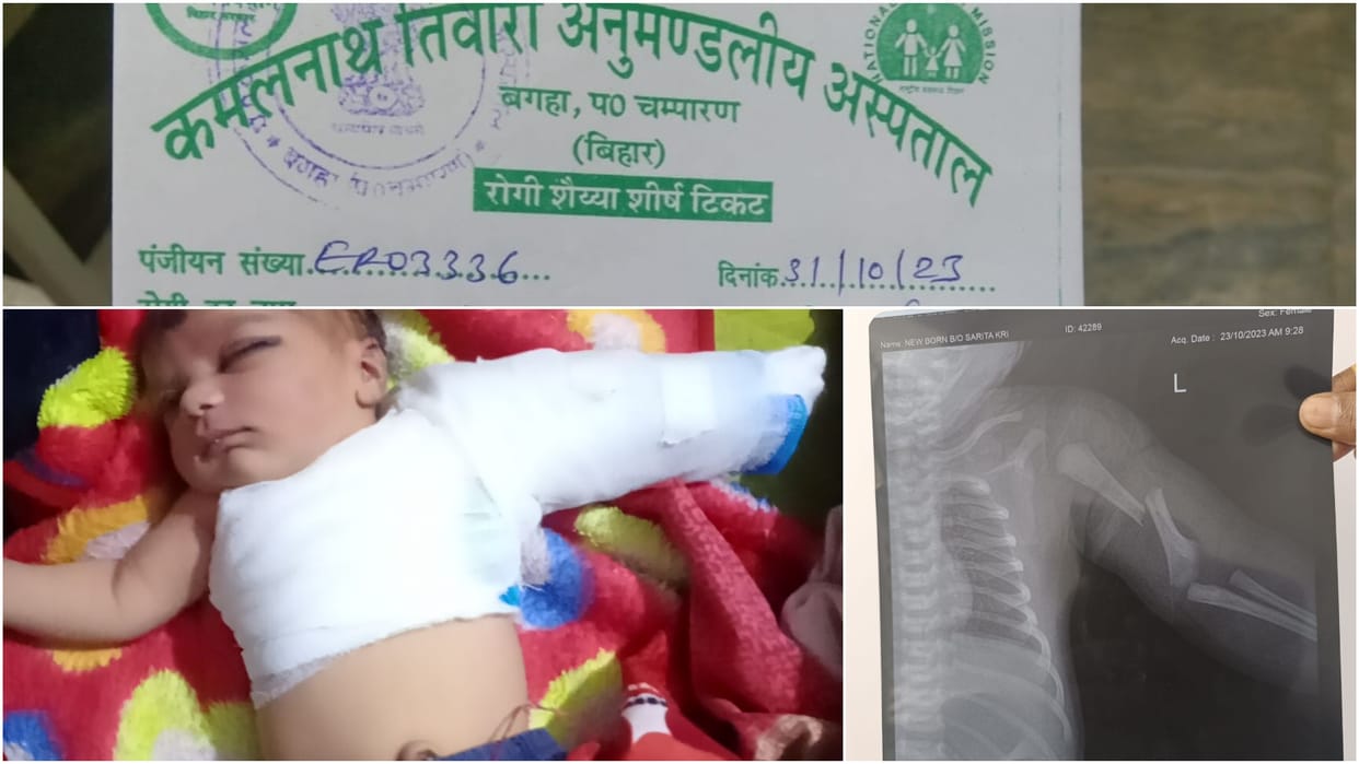 Bihar : Newborn's arm broken during delivery, Asha took him from government hospital to private hospital