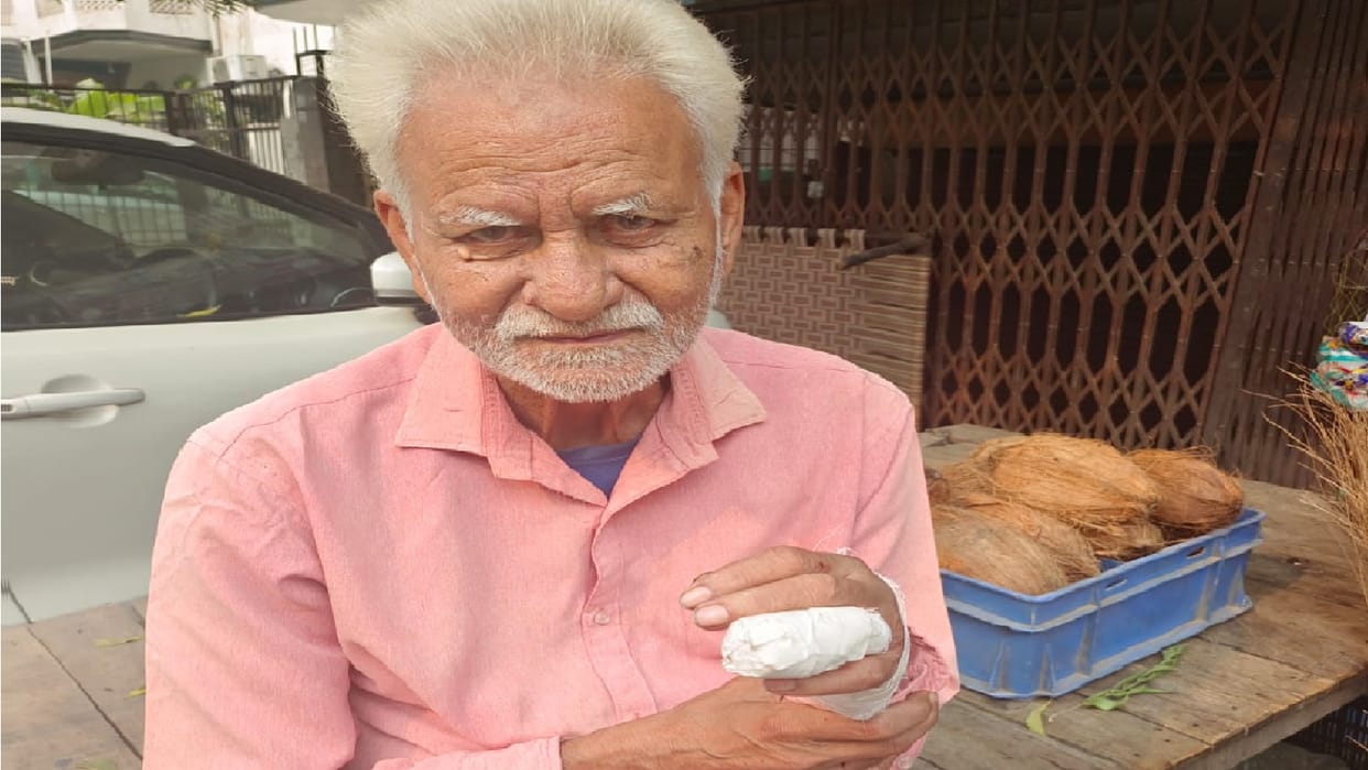 Thief bit elderly man s finger yet old man did not leave him