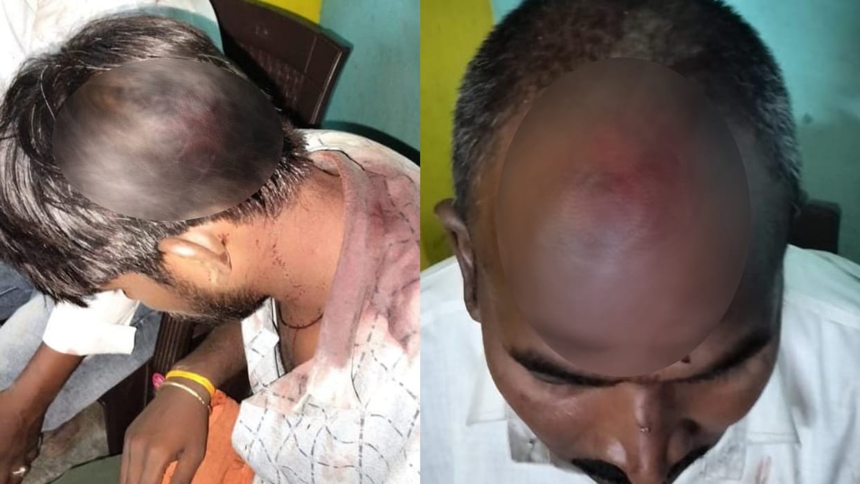 Injured did not get treatment in civil hospital in lucknow.