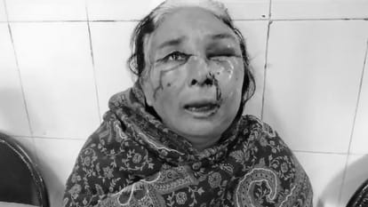 man tried to burn wife alive and beaten brutally his mother-in-law in bareilly